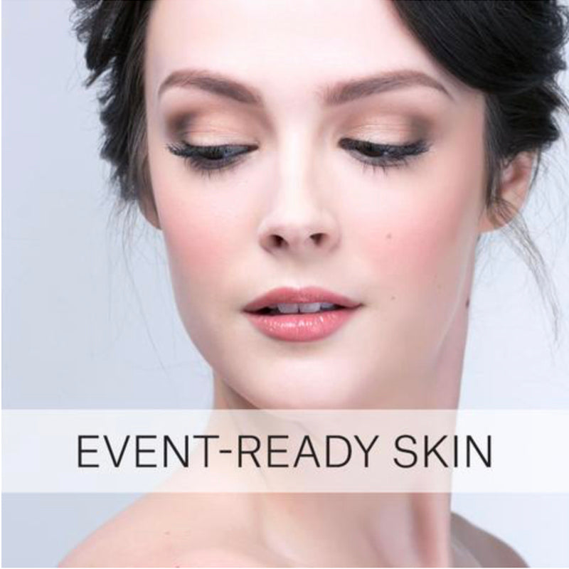 Skincare S.O.S. | Getting Your Skin Event-Ready