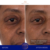 augustinus-bader-the-eye-patches-reduce-fine-lines-dark-circles-puffiness