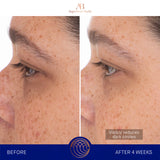 augustinus-bader-the-eye-patches-reduce-dark-circles