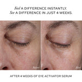 Before and after 4 weeks of Westman Atelier Eye Activator Serum