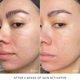 Before and after 2 weeks of Westman Atelier Skin Activator